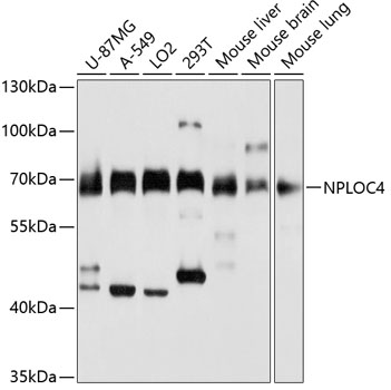 NPLOC4 Rabbit polyclonal antibody