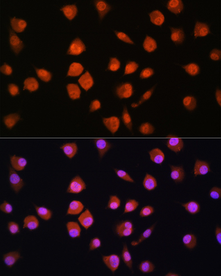 NPLOC4 Rabbit polyclonal antibody