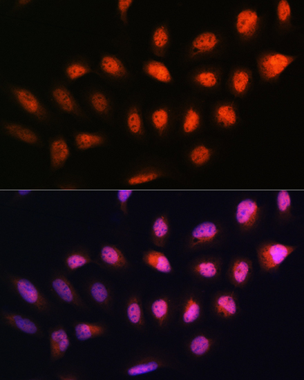 NPLOC4 Rabbit polyclonal antibody