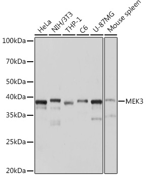 MEK3 Rabbit monoclonal antibody