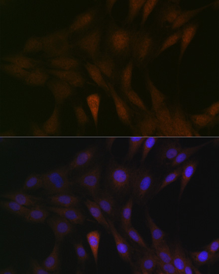 MEK3 Rabbit monoclonal antibody