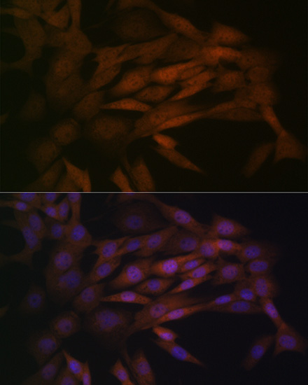 MEK3 Rabbit monoclonal antibody