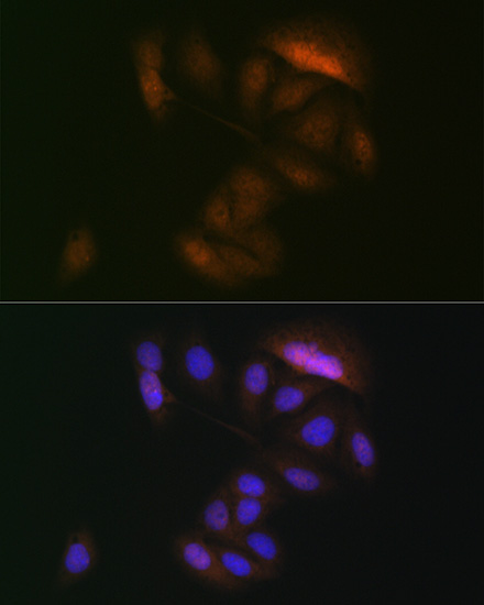 MEK3 Rabbit monoclonal antibody