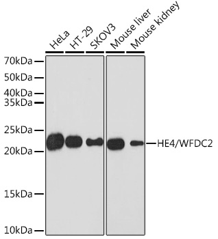 HE4/WFDC2 Rabbit monoclonal antibody