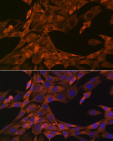 HE4/WFDC2 Rabbit monoclonal antibody