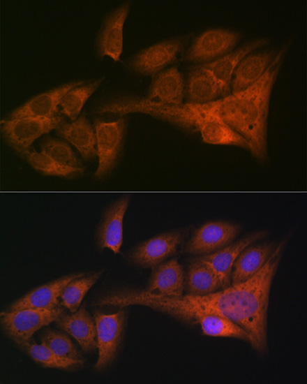 HE4/WFDC2 Rabbit monoclonal antibody