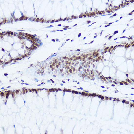 [KO Validated] Histone H1.0 Rabbit polyclonal antibody