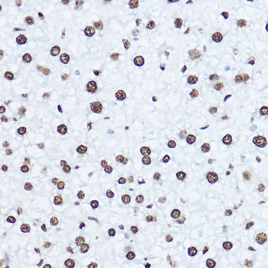 [KO Validated] Histone H1.0 Rabbit polyclonal antibody