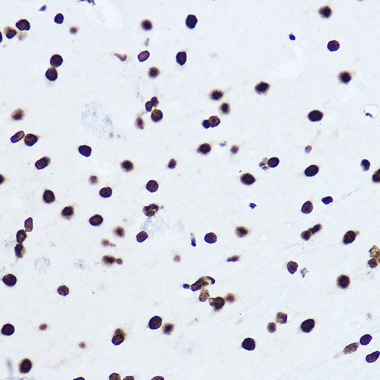 [KO Validated] Histone H1.0 Rabbit polyclonal antibody