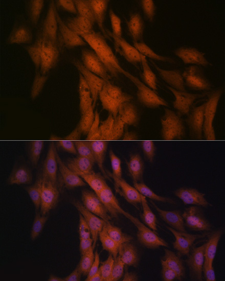 Gli3 Rabbit monoclonal antibody