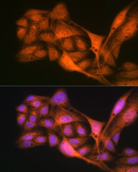 Gli3 Rabbit monoclonal antibody