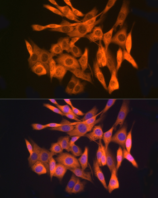 Gli3 Rabbit monoclonal antibody