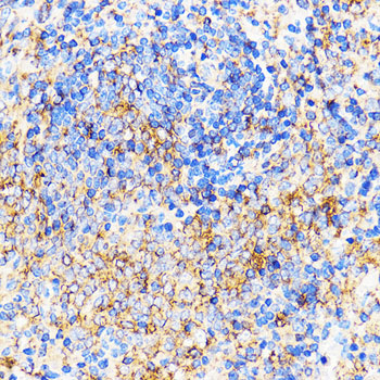CXCR2 Rabbit polyclonal antibody