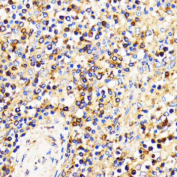 CXCR2 Rabbit polyclonal antibody