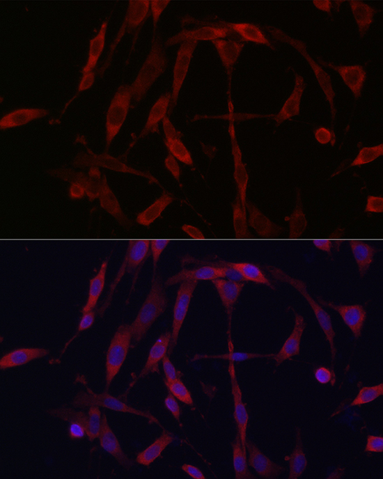 KIF5A Rabbit polyclonal antibody
