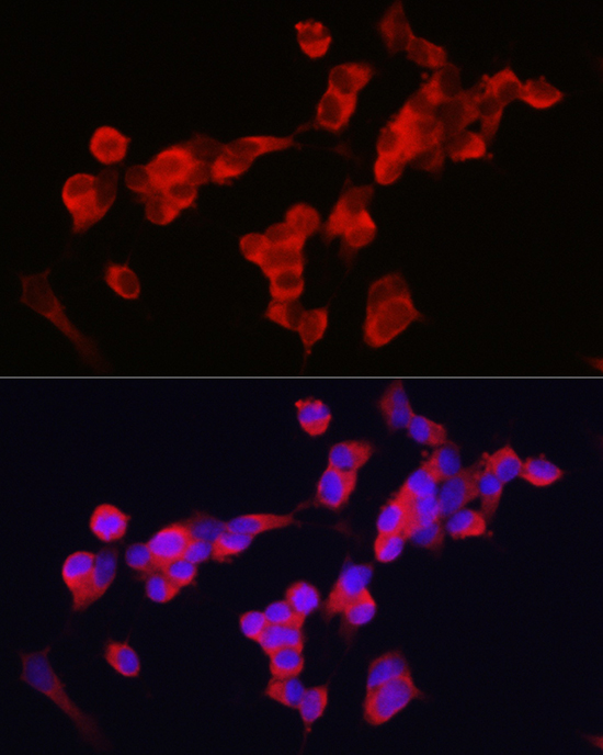 KIF5A Rabbit polyclonal antibody
