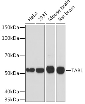 TAB1 Rabbit monoclonal antibody