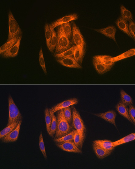 TAB1 Rabbit monoclonal antibody
