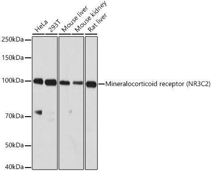 Mineralocorticoid receptor (NR3C2) Rabbit polyclonal antibody