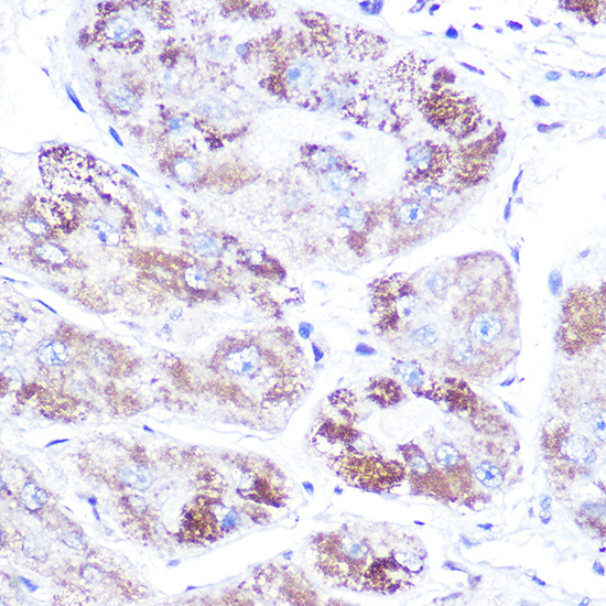 Mineralocorticoid receptor (NR3C2) Rabbit polyclonal antibody