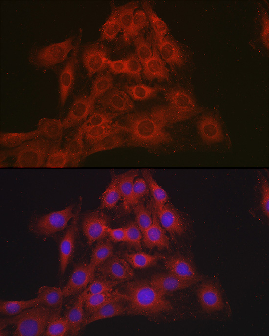 Mineralocorticoid receptor (NR3C2) Rabbit polyclonal antibody