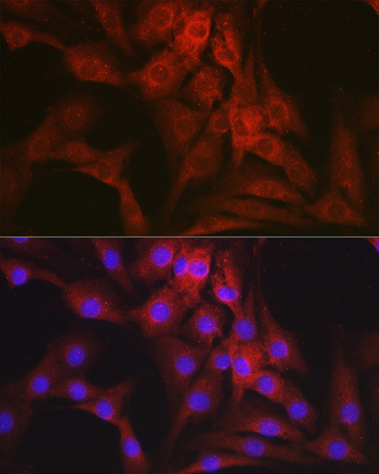 Mineralocorticoid receptor (NR3C2) Rabbit polyclonal antibody