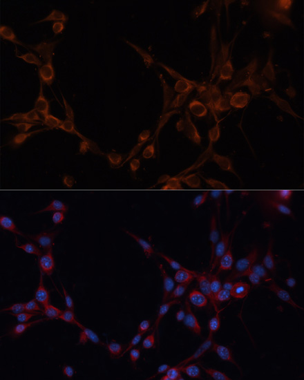 ALDH6A1 Rabbit polyclonal antibody