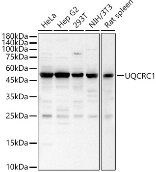 UQCRC1 Rabbit polyclonal antibody