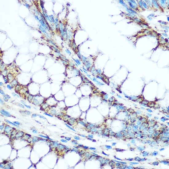 UQCRC1 Rabbit polyclonal antibody