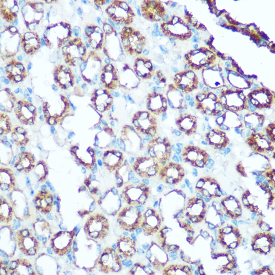 UQCRC1 Rabbit polyclonal antibody