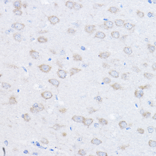 UBE4A Rabbit polyclonal antibody