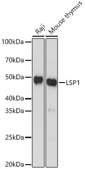 LSP1 Rabbit monoclonal antibody