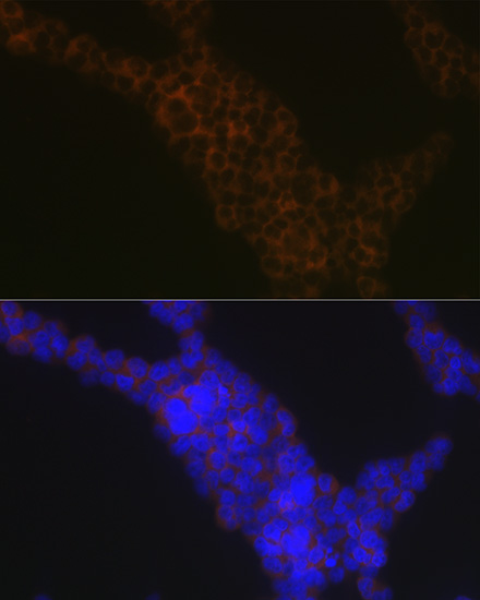 LSP1 Rabbit monoclonal antibody