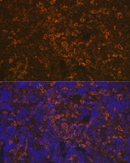 LSP1 Rabbit monoclonal antibody