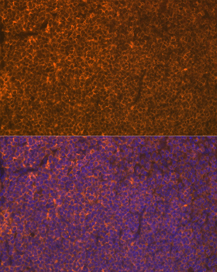 LSP1 Rabbit monoclonal antibody