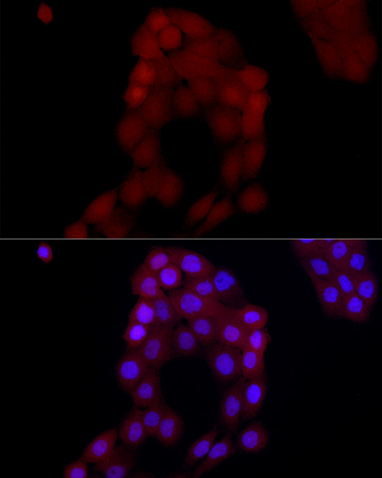 AIM2 Rabbit polyclonal antibody