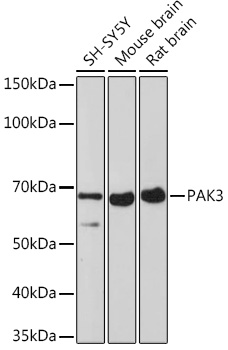 PAK3 Rabbit monoclonal antibody