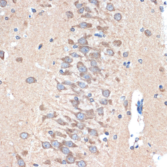 PAK3 Rabbit monoclonal antibody