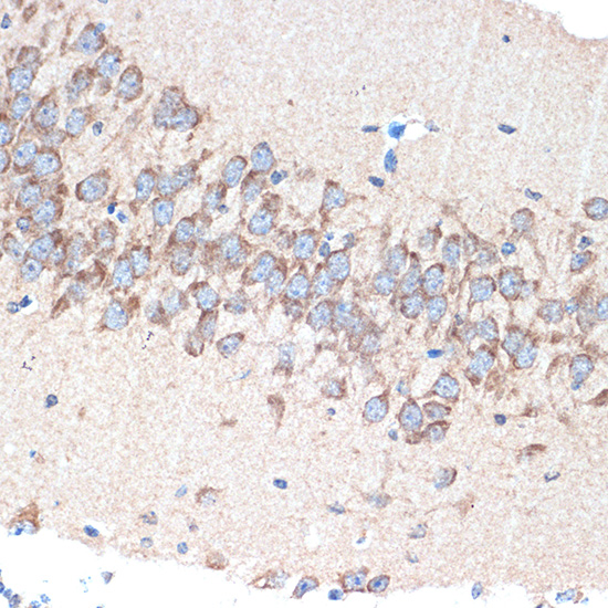 PAK3 Rabbit monoclonal antibody