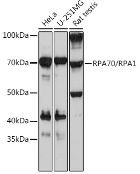 RPA70/RPA1 Rabbit monoclonal antibody