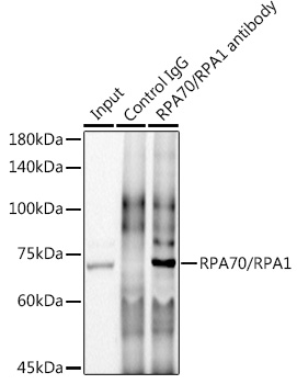 RPA70/RPA1 Rabbit monoclonal antibody