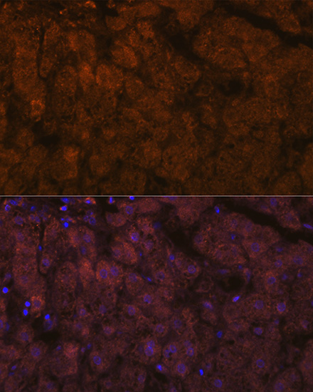 ADAMTS13 Rabbit monoclonal antibody