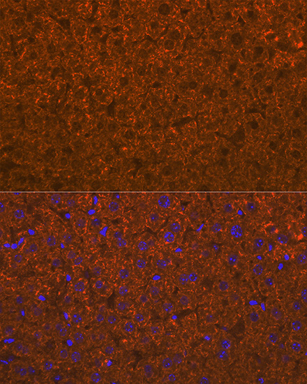 ADAMTS13 Rabbit monoclonal antibody