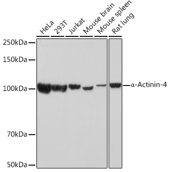 A Alpha-Actinin-4 Rabbit monoclonal antibody