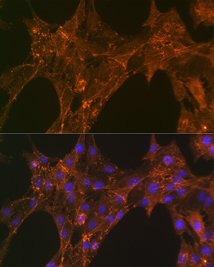 A Alpha-Actinin-4 Rabbit monoclonal antibody