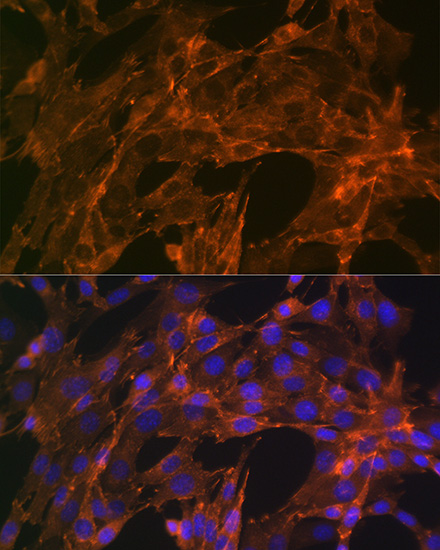 A Alpha-Actinin-4 Rabbit monoclonal antibody