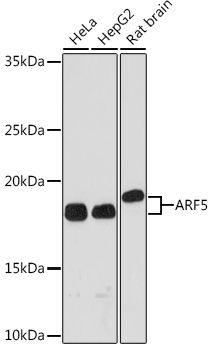 ARF5 Rabbit monoclonal antibody