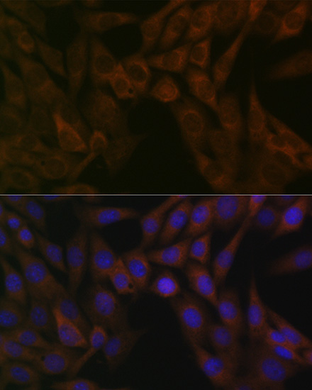 ARF5 Rabbit monoclonal antibody