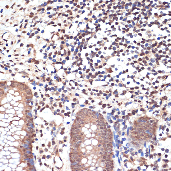 KAT8/MYST1/MOF Rabbit monoclonal antibody