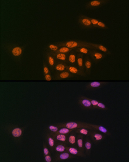 KAT8/MYST1/MOF Rabbit monoclonal antibody